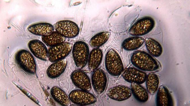 Ritorna l’alga tossica a Quercianella