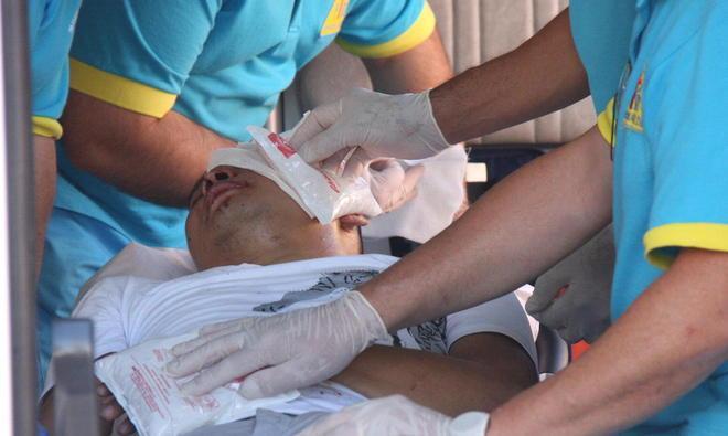 Tampona un'auto Cinese picchiato a sangue 