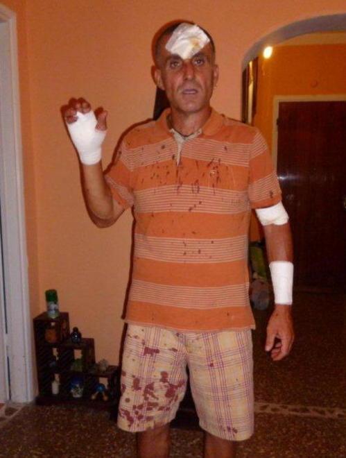 Dopo le offese le coltellate, arrestato 