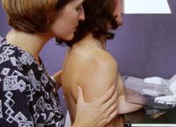 Donne in corsa contro il tumore alla mammella 