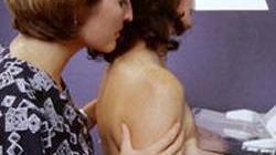 Donne in corsa contro il tumore alla mammella