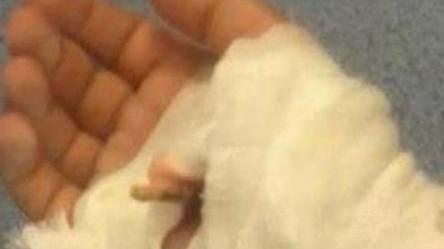 «Mio figlio ferito da un chiodo dimenticato dal Comune»