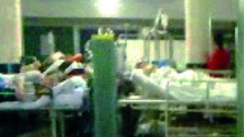 Primi 10 letti per i pazienti in coma