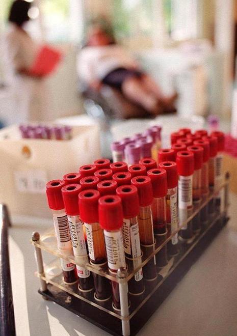 Aids, a rischio anche chi ha più di 50 anni Complice il Viagra 