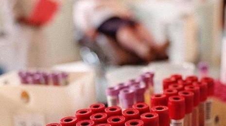 Aids, a rischio anche chi ha più di 50 anni Complice il Viagra