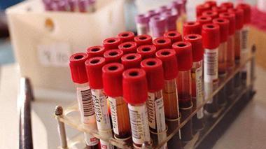 Analisi, disagi per gli esami da ripetere