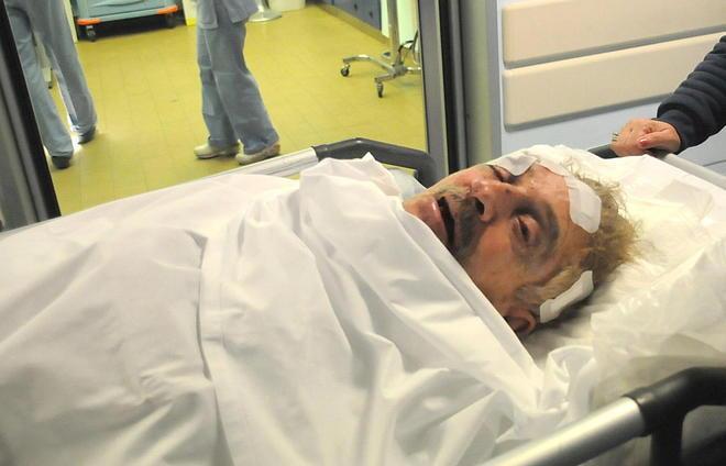 Picchiato a sangue il partigiano Lilio Giannecchini 