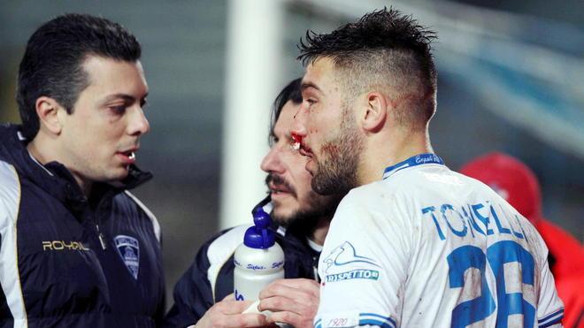 Azzurri: salva la stagione di Casoli, Tonelli si opera al naso