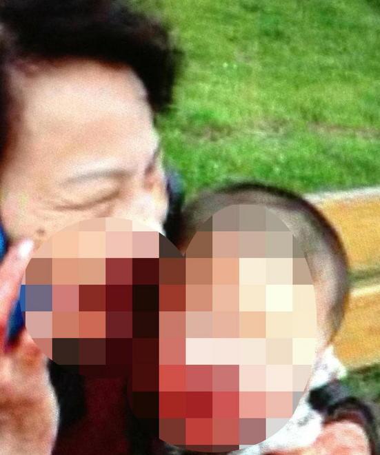 Nonna e nipote sfigurati dal cane 