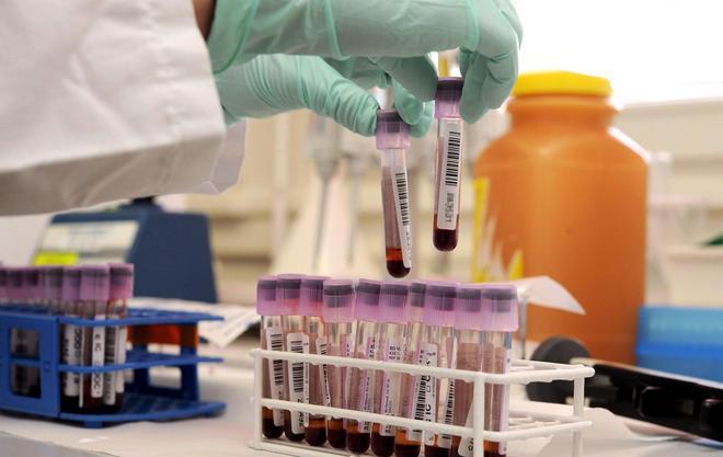 Un gene manda il sangue in tilt E c’è un secondo caso a Roselle