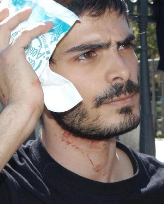 Fuori una dura contestazione la polizia carica: un ferito