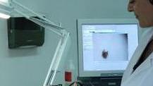Skin cancer, Livorno maglia nera in Toscana