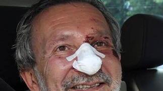 Il sindaco Giuseppe Bellandi dimesso dall’ospedale di Pescia