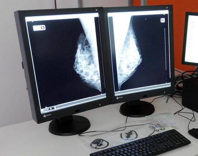 Fumano troppo e sono grassi, ma hanno più chance di guarire dai tumori