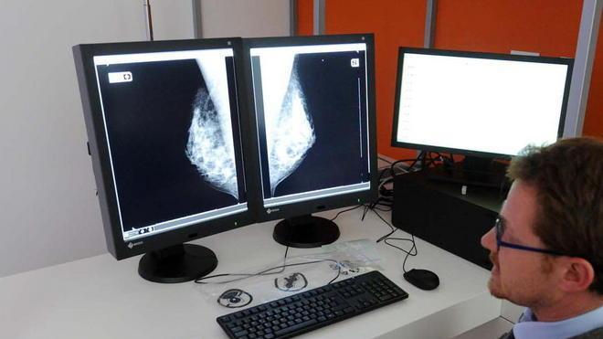 Dimezzate le mammografie per consentire le ferie