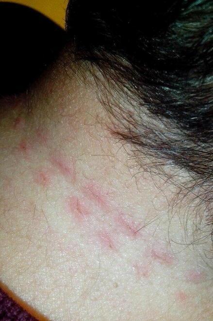 Colpita da infarto dopo l’aggressione «È stato un incubo» 
