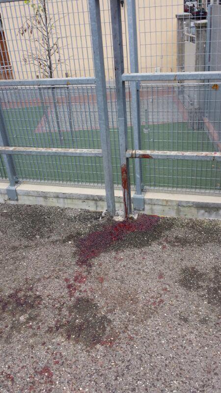 Anziano aggredito sulla pista ciclabile: 40 punti di sutura alla testa
