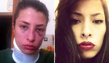 Ci metto la faccia per dirvi: donne, mai più ridotte così