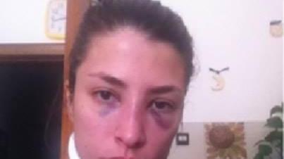 Violenza sulle donne, Laura Boldrini telefona a Jessica Rossi