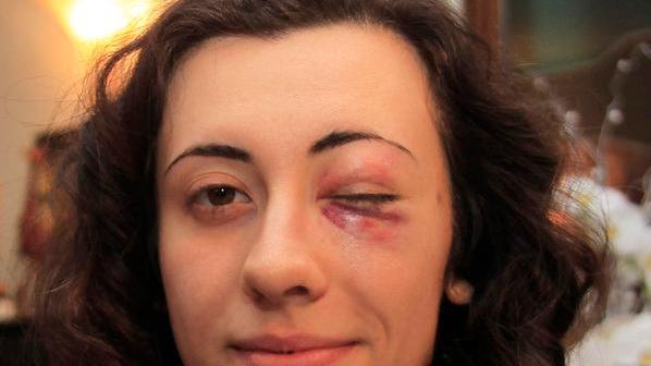 Carpi, rapine con botte: sei anni a un 25enne modenese