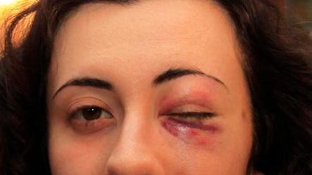 «Non provo odio, ma la condanna mi sembra giusta»