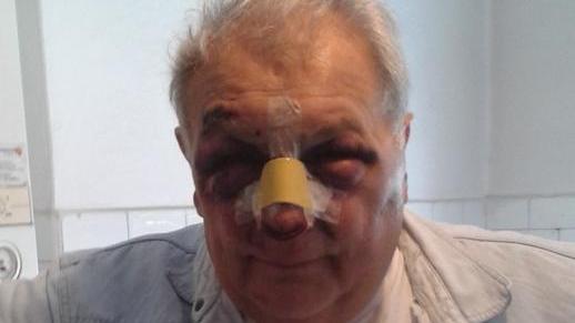 «Mi hanno massacrato e non so perché»