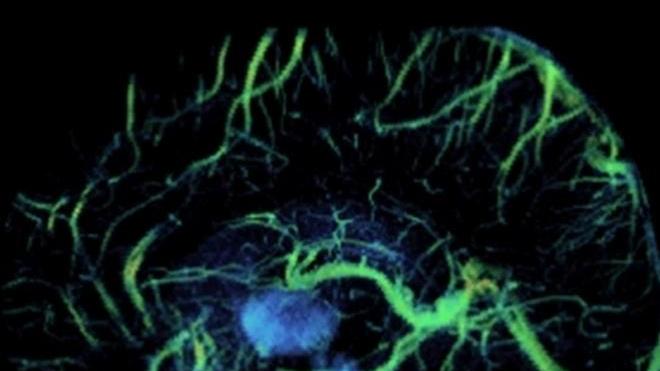 Nel labirinto dei vasi sanguigni