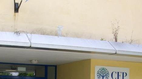 Un caso di Tbc polmonare, ragazzo di 15 anni ricoverato