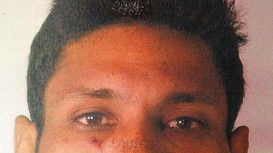 A processo per il tentato omicidio