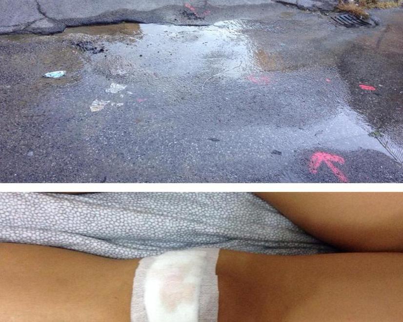 Bambino cade dalla bici per una perdita d’acqua in strada 