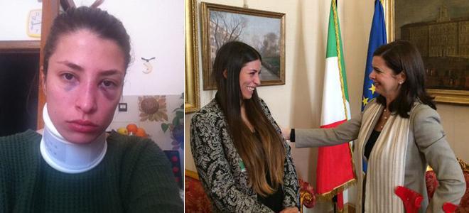 Jessica Rossi, ragazza simbolo delle donne maltrattate, denunciata per violenza sessuale (per un bacio)