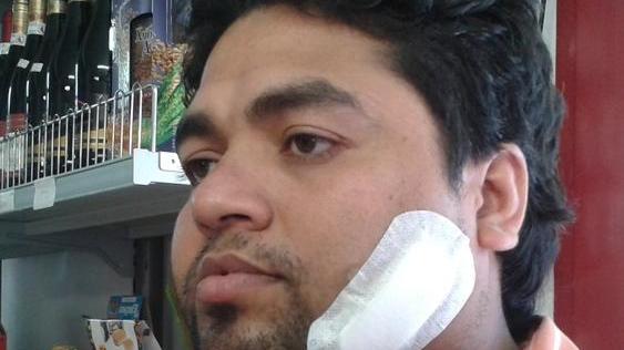 Ancora grave l’uomo in coma Polizia, è caccia ai banditi