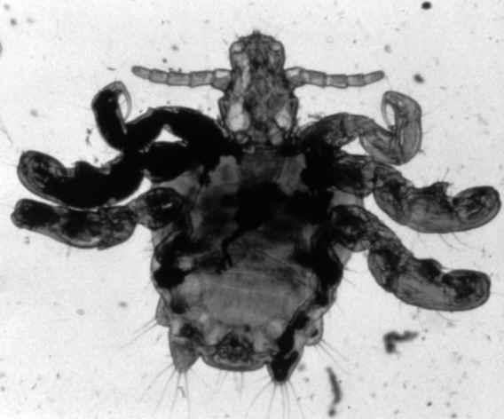 Due casi di scabbia in una scuola materna