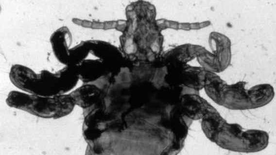 Due casi di scabbia in una scuola materna