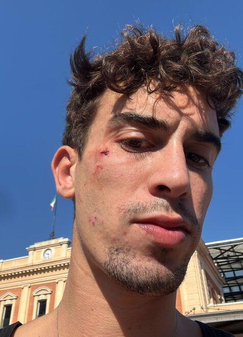 Il coraggio di chiamarsi fuori: quando l'odio colpisce anche i nostri giovani