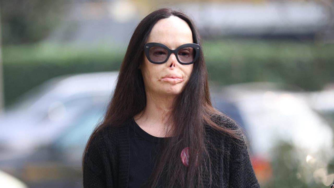 valentina pitzalis prima e dopo